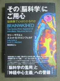 その<脳科学>にご用心　脳画像で心はわかるのか