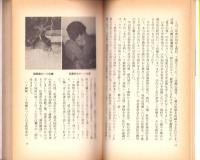 驚異のツボ療法　-ハリを使わない　ハリ麻酔応用治療-　K BOOKS