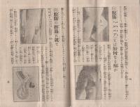 孝子脱膓矯正器の由来　〔孝子一大発明の実話〕　（仁風堂・東京市）