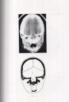 シェーマによる全身の正常CT像　（秋田大学医学部放射線科）