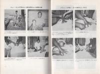 トニーの素手　フィリピンにおける心霊外科手術報告書
