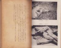 殺人の法医学