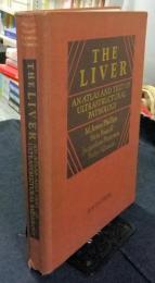 THE LIVER An Atlas and Text of Ultrastructural Pathology　洋書
