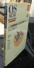 OS NOW　Instruction　No.25 : 整形外科手術の新標準　人工関節置換術の合併症対策テクニック　予防と対処のコツ