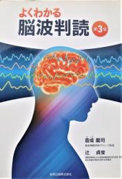 よくわかる脳波判読