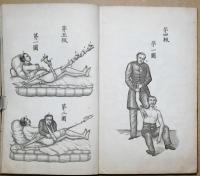 整骨説略　附録