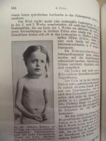 ［独文］ LEHRBUCH DER KINDERHEILKUNDE　　HERAUSGEBEN VON E.FEER