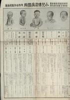 小児急性伝染病