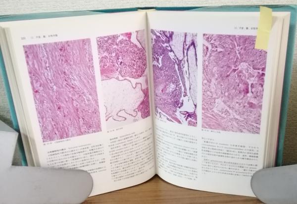 前眼部アトラス、後眼アトラス、病理アトラス3冊セット - 健康・医学