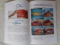 バスキュラーアクセス実践ガイド = 写真から学ぶ作り方と考え方　 Practical Guide for Vascular Access :