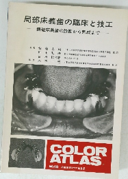 局部床義歯の臨床と技工