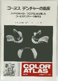 コーヌスデンチャーの臨床