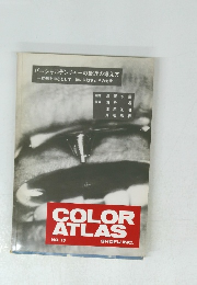 パーシャルデンチャーの最近の考え方 一症例を中心として、 特に失敗例とその対策一