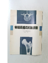 骨粗鬆症のX線診断