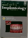 DENTAL　Implantology　2009年6月号　