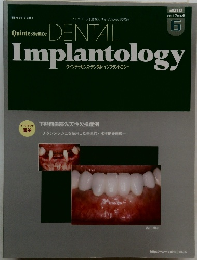 Quintessence  DENTAL　Implantology　2010－6