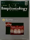 DENTAL Implantology 2010年3月号　Vol.17No.3