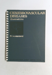 CEREBROVASCULAR  DISEASES  illustrations
