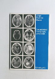Lange  Grumme  Meese  Computerized  Tomography  of the Brain