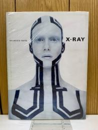 X-RAY