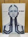X-RAY