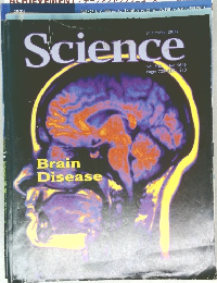 Science 2003/10/31  Brain Disease