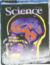 Science 2003/10/31  Brain Disease