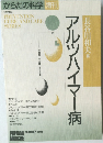 アルツハイマー病