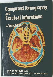 Computed Tomography and Cerebral Infarctions
