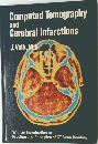 Computed Tomography and Cerebral Infarctions