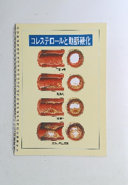 コレステロールと動脈硬化