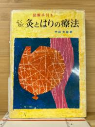 よく効く灸とはりの療法 : 図解手引き