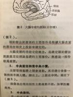 簡明頭針療法
