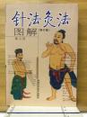 针法灸法图解