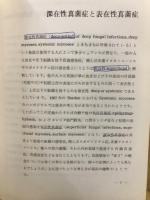 真菌性疾患とその治療