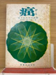 癌　隠されたその実体