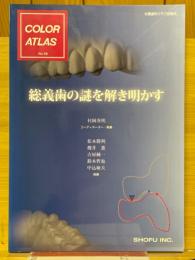 総義歯の謎を解き明かす