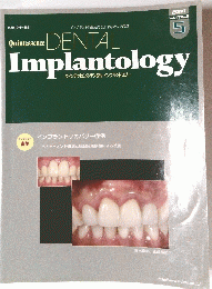 Dental　Implantology　2010年5月号
