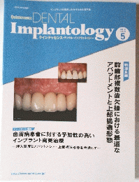 Quintessence DENTAL Implantology　2012年5月号