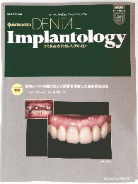 DENTAL Implantology　2011年5月号