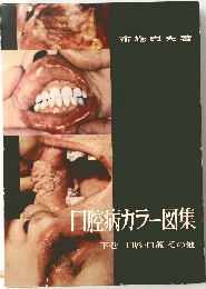 口腔病カラー図集　下　口唇・口蓋その他