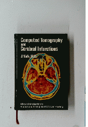 Computed Tomography and Cerebral Infarctions