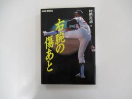 右腕の傷あと