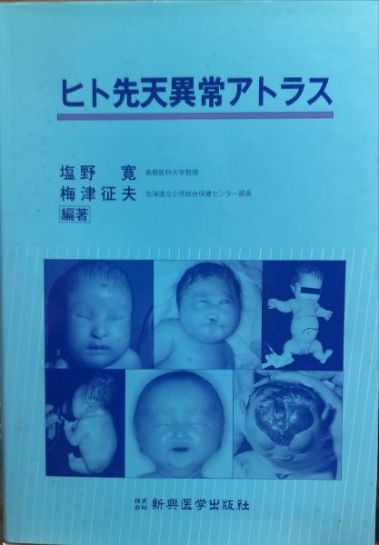 ヒト先天異常アトラス(塩野寛, 梅津征夫 編著) / 古本、中古本、古書籍 