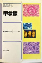 甲状腺 ＜取扱い規約に沿った腫瘍鑑別診断アトラス＞