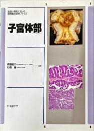 子宮体部 取扱い規約に沿った腫瘍鑑別診断アトラス