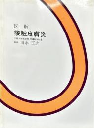 図解 接触皮膚炎