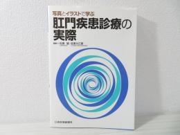 写真とイラストで学ぶ肛門疾患診療の実際