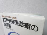 写真とイラストで学ぶ肛門疾患診療の実際