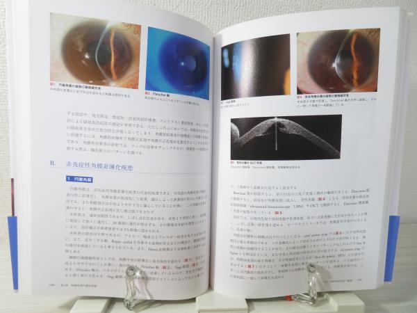 オキュラーサーフェス疾患 : 目で見る鑑別診断(西田幸二, 天野史郎